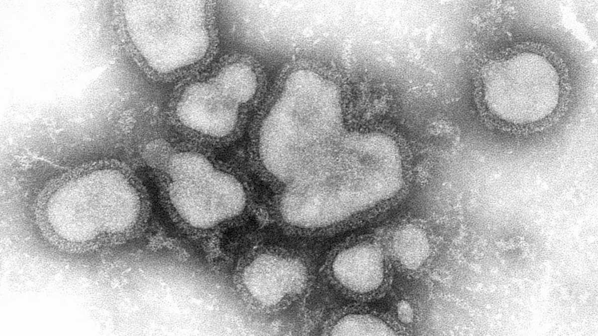 Influenza A virus (CDC)