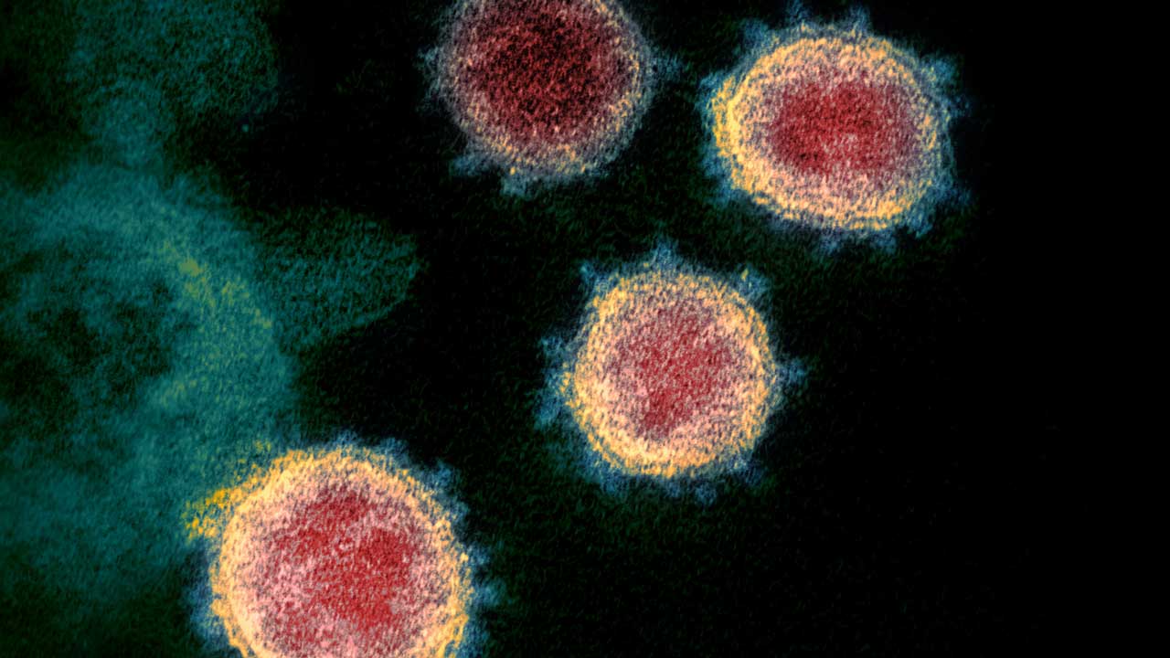 sars-cov-2-coronavirus Electron microscope image of SARS-CoV-2 in cell culture (Image by NIAID, Licenced under CC BY 2.0)