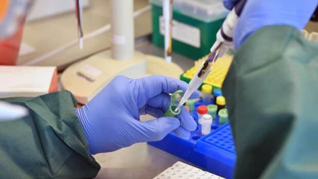 A molecular biologist prepares an RT-PCR reaction (Photo: IAEA, licensed under CC BY 2.0)